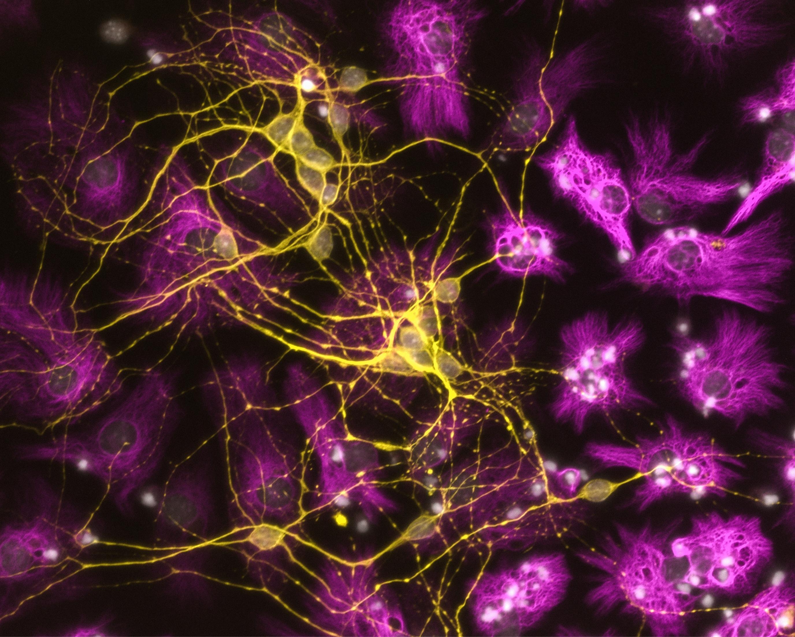A winning trajectory for neural stem cell artwork - Queensland